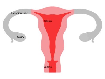 Female reproductive system after a bilateral salpingo-oophorectomy