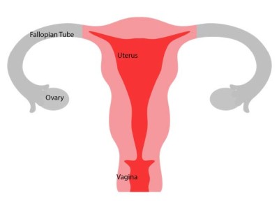 Female reproductive system after a bilateral salpingo-oophorectomy