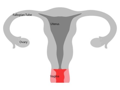 female reproductive system after a hysterectomy and bilateral salpingo-oophorectomy