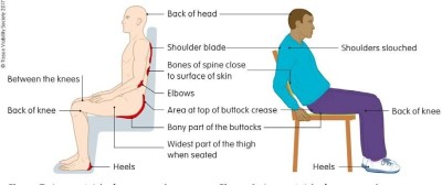 Where do pressure ulcers develop when seated